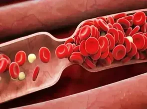 Blood quality, blood type and importance of blood clotting