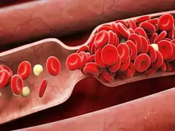 Blood quality, blood type and importance of blood clotting
