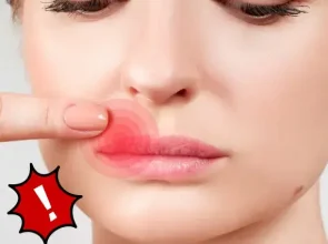 Herpes virus and Alzheimer’s Disease, Hidden Connection