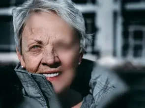 Wrinkles, How Aging Changes Our Appearance