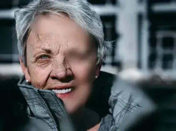 Wrinkles, How Aging Changes Our Appearance